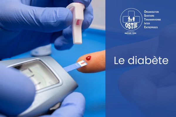 Le Diabète : types, cause et prévention en milieu professionnel